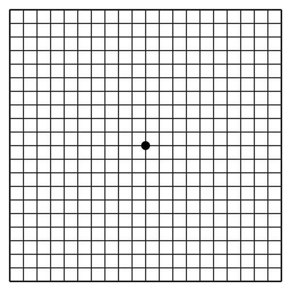 Amsler-Gitter: quadratisches Gitternetz mit Punkt in der Mitte